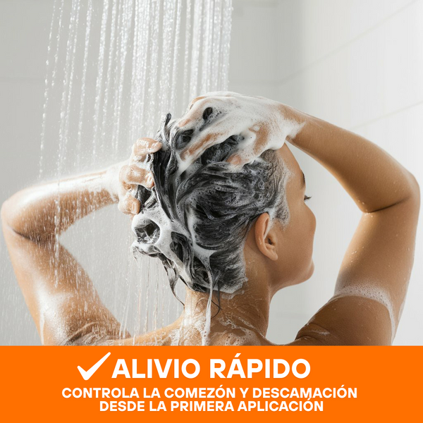 SHAMPOO CONTROL PSORIASIS TRATAMIENTO PARA 3 MESES